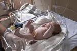 新生兒流行性腹瀉 K52.955 新生兒傳染性腹瀉 新生兒感染性腹瀉