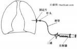 小兒膿胸 小兒化膿性胸膜炎