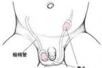 小兒後尿道瓣膜 小兒先天性尿道瓣膜 小兒先天性男性尿道瓣膜