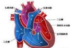 肺動脈瓣狹窄 單純肺動脈口狹窄