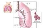 新生兒濕肺 P22.102 第Ⅱ型呼吸窘迫綜合 新生兒暫時性呼吸困難
