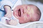 新生兒溶血病 同族免疫性溶血病 母嬰血型不合性溶血病