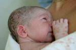 新生兒膿皰病 L00.X01 新生兒天皰瘡