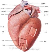 小兒擴張型心肌病 小兒充血型心肌病