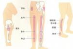 坐骨神經痛 M54.381 偏痹