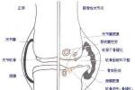 髕股關節疼痛 Patellofemoral joint pain