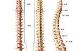 腰椎椎管狹窄癥 椎管狹窄 腰椎狹窄