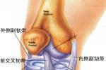 膝關節韌帶損傷 前交叉韌帶損傷