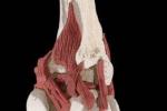 十字韌帶損傷 Cruciate ligament injury