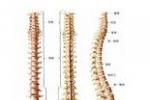 青年性駝背 少年駝背癥 Scheuermann病