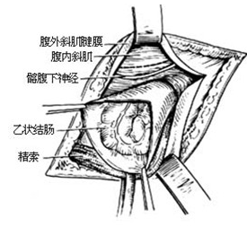 肌疝 M62.891 肌突出