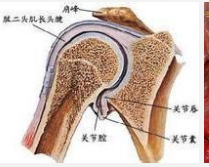 喙突胸小肌綜合征