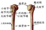 肱骨外科頸骨折 S42.201 肱骨外髁頸骨折