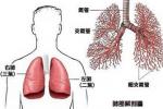 肺癌 支氣管癌 支氣管肺癌 肺部惡性腫瘤