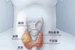 甲狀腺癌 惡性甲狀腺腫 石癭