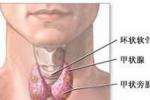 甲狀腺癌 惡性甲狀腺腫 石癭