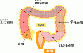 結直腸癌 大腸癌