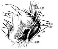 網膜腫瘤 Tumors of the Omentum 大網膜腫瘤