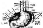 網膜腫瘤 Tumors of the Omentum 大網膜腫瘤