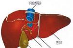 肝癌 原發性肝癌