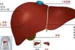原發性肝癌 肝癌 primary carcinoma of the liver