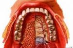 牙齦癌