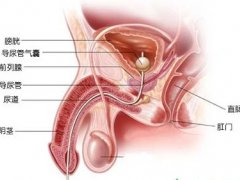 男性尿道癌