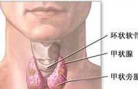 老年人甲狀腺癌 老年甲狀腺癌老年人惡性甲狀腺腫老年惡性甲狀腺腫