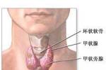 老年人甲狀腺癌 老年甲狀腺癌老年人惡性甲狀腺腫老年惡性甲狀腺腫