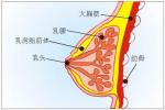 乳腺脂肪肉瘤 乳腺脂肉瘤乳房成脂細胞瘤乳房脂母細胞瘤