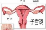 生殖道腫瘤 genital tract tumors