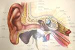 外耳道乳頭狀瘤 D23.251 