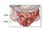 小腸纖維瘤