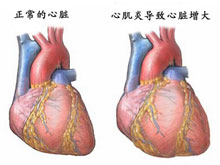 病毒性心肌炎 I40.001 