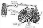 感染性心內膜炎 I33.004 