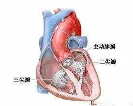 三尖瓣關閉不全