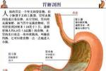 胃動脈硬化 動脈粥樣硬化