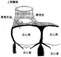 自律性房性心動過速 特發性房性心動過速 自律性增強性房性心動