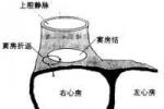 自律性房性心動過速 特發性房性心動過速 自律性增強性房性心動