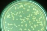 假單胞菌感染 A49.804 