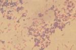 葡萄球菌感染 A49.002 葡萄球菌病