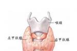 亞急性甲狀腺炎 病毒性甲狀腺炎 DeQuervain甲狀腺炎 肉芽腫性甲狀腺炎 巨細胞性甲狀腺炎