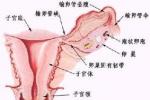 特發性青春期延遲