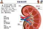 狼瘡腎炎 狼瘡性腎炎 系統性紅斑狼瘡性腎炎