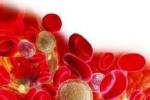 血紅蛋白病 海洋性貧血