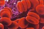 真性紅細胞增多癥 真紅