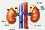 腎炎 慢性腎炎 慢性腎小球腎炎 腎小球腎炎