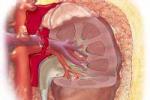 腎囊腫 單純性腎囊腫 孤立性腎囊腫 renal cyst cyst of kidney