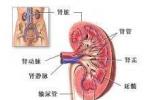 腎盂腎炎 腎盂炎癥 上尿路感染 pyelonephritis