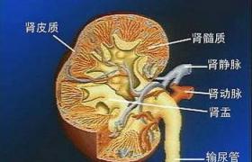 急性腎炎 N00.902 急性腎小球腎炎 急性感染後腎小球腎炎 急性鏈球菌感染後腎